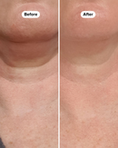 Serum Firmador para o Pescoço Efeito botox Neck Firming Serum