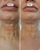 Serum Firmador para o Pescoço Efeito botox Neck Firming Serum
