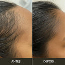 Escova de Terapia Capilar: Queda de Cabelo = TheraBrush Smarts 4 em 1