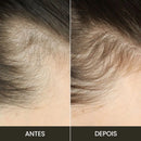 Escova de Terapia Capilar: Queda de Cabelo = TheraBrush Smarts 4 em 1